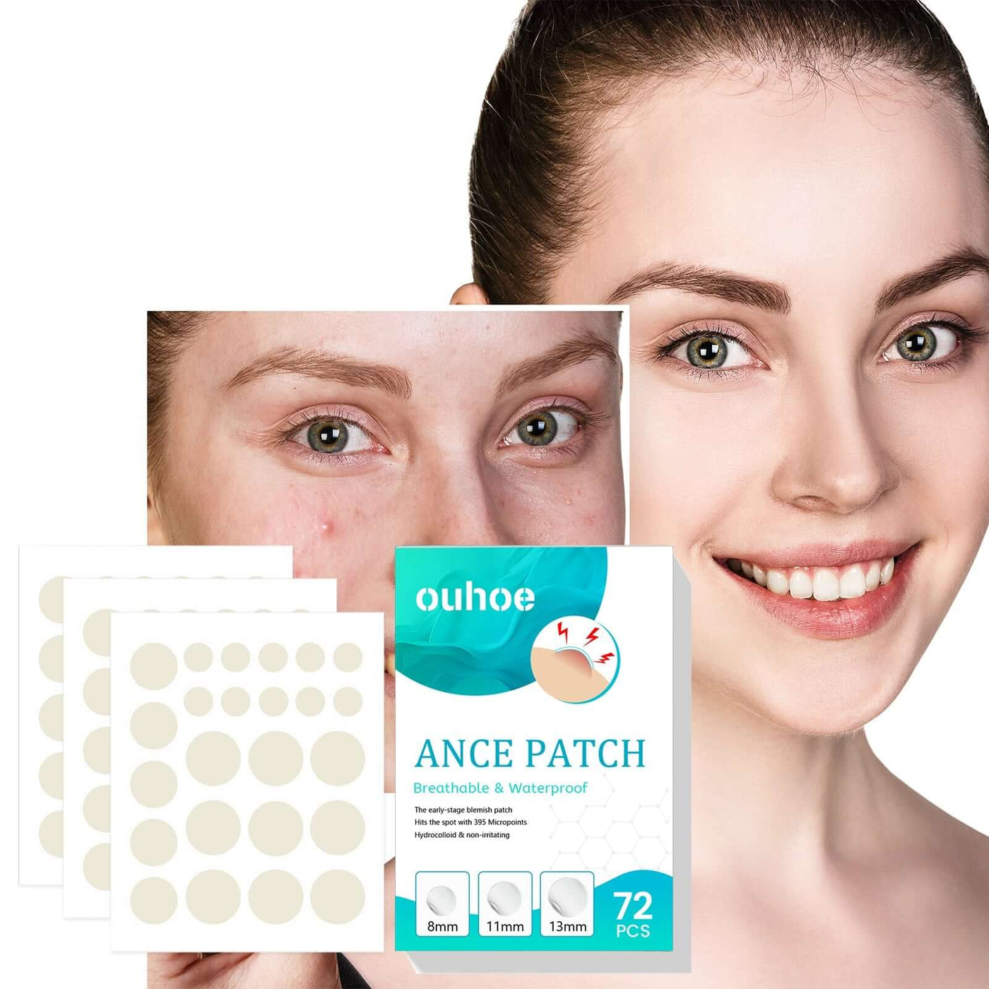 Acne Patch, Repair Facial Acne Invisible Concealer Hydrocolloid Patch eprolo