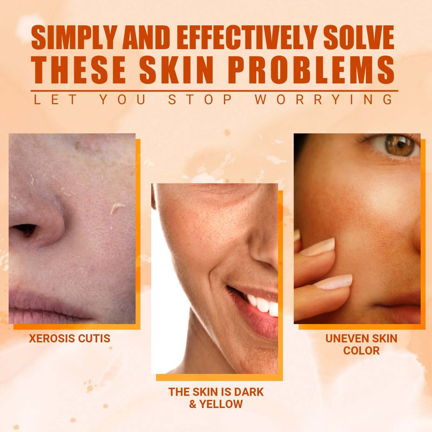 Vitamin C Moisturizing Spray Hydrates And Moisturizes Skin, Lightening Acne Spots And Whitening Spray eprolo