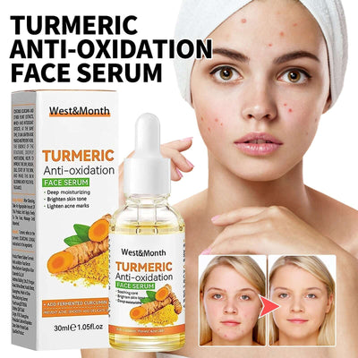Turmeric Facial Essence, Moisturizing Lightening Spots, Acne Marks, Brightening Skin Essence eprolo