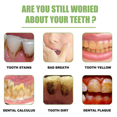 Teeth Whitening Serum To Remove Stains, Bad Breath, Whitening Teeth And Whitening Teeth eprolo