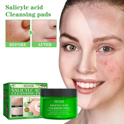 Salicylic Acid Cleaning Gasket, Moisturizing Oil Control Removing Blackheads And Acne Closing Gentle Cleansing Acne Muscle Repair eprolo