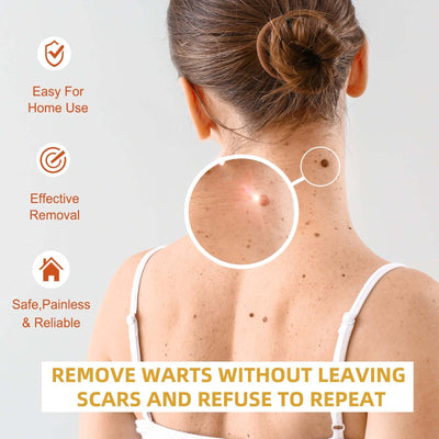 Anti-wart Essence, Anti Warts Fade Moles Corns Smoothing Skin Care Essence eprolo