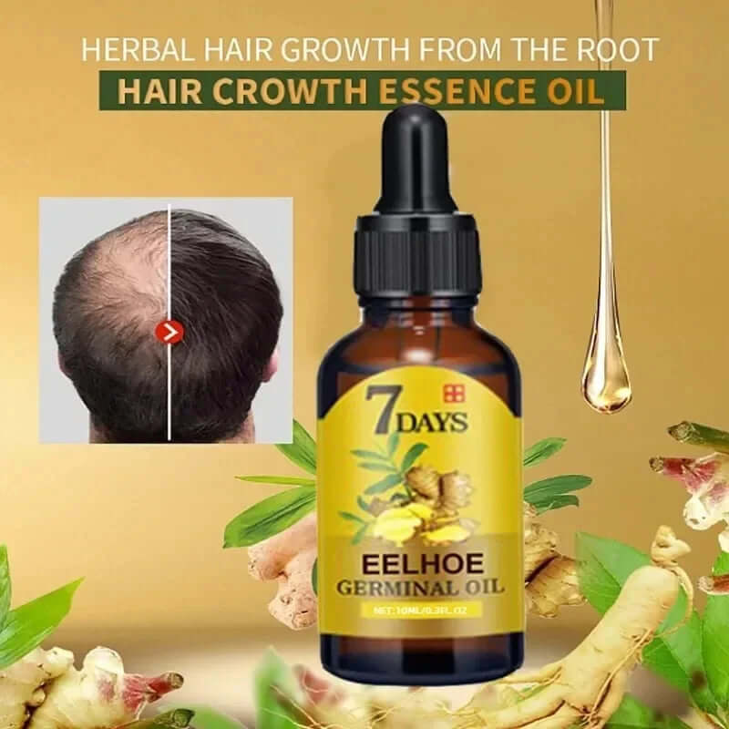 7 Day Fast Hair Growth Oil Ginger Growth Hair Treatment Anti Hair Loss Men Women Scalp Treatment Serum Products Beauty Product eprolo