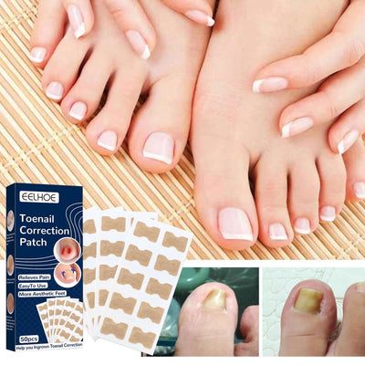 Nail Correction Patch, Nail Insert Correction And Repair Toe Manicure Nail Patch eprolo