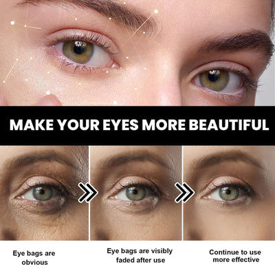 Eye Firming Cream, Relieves Bags, Black Eyes, Firms, Moisturizes, Repairs Skin Eyes Cream eprolo