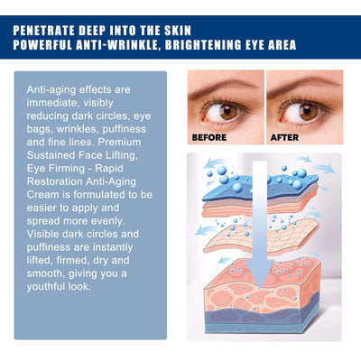 Collagen Black Circle Eye Cream, Reduces Lines Moisturizes And Repairs Skin Eye Cream eprolo