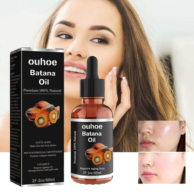 Batana Essential Oil, Hair Smoothing Anti-Loss Nourishing Skin Care Essential Oil eprolo