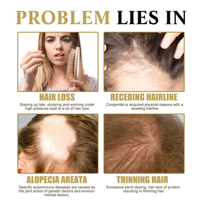 Ginseng Massage Essence, Moisturizes Scalp Strengthens Hair Prevents Loss Hair Care Essence eprolo