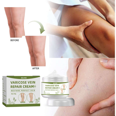 Leg Repair Cream Relieves Leg Discomfort Massage Leg Repair Cream For Raised Veins eprolo