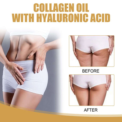 Firming Collagen Oil, Shows The Curves Of The Body, Firming Shaping And Slimming Body Essential Oil eprolo