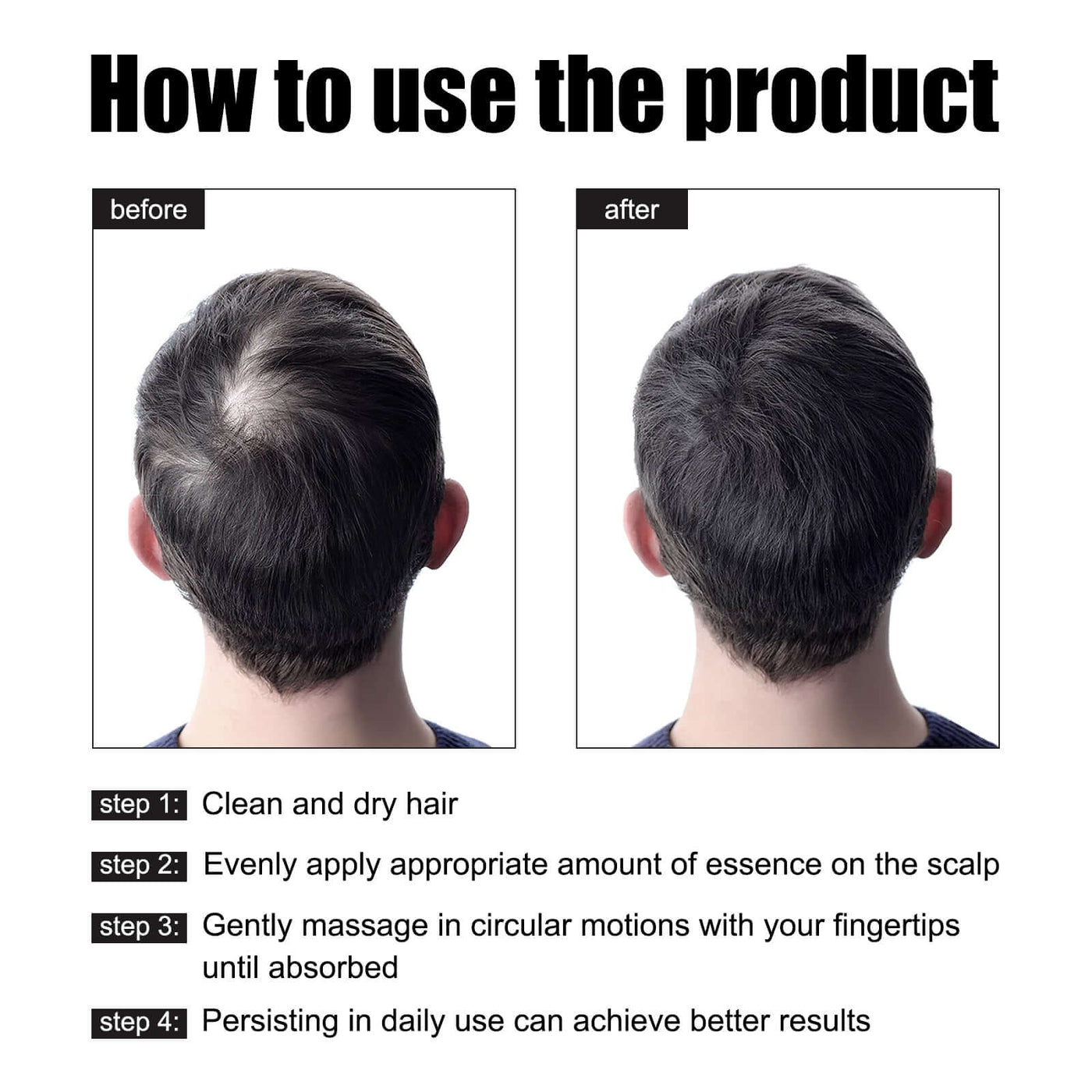Men's Dense Hair Essence, Strengthening Nourishing Solid Hair Care Solution eprolo