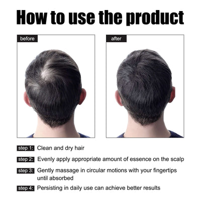 Men's Dense Hair Essence, Strengthening Nourishing Solid Hair Care Solution eprolo