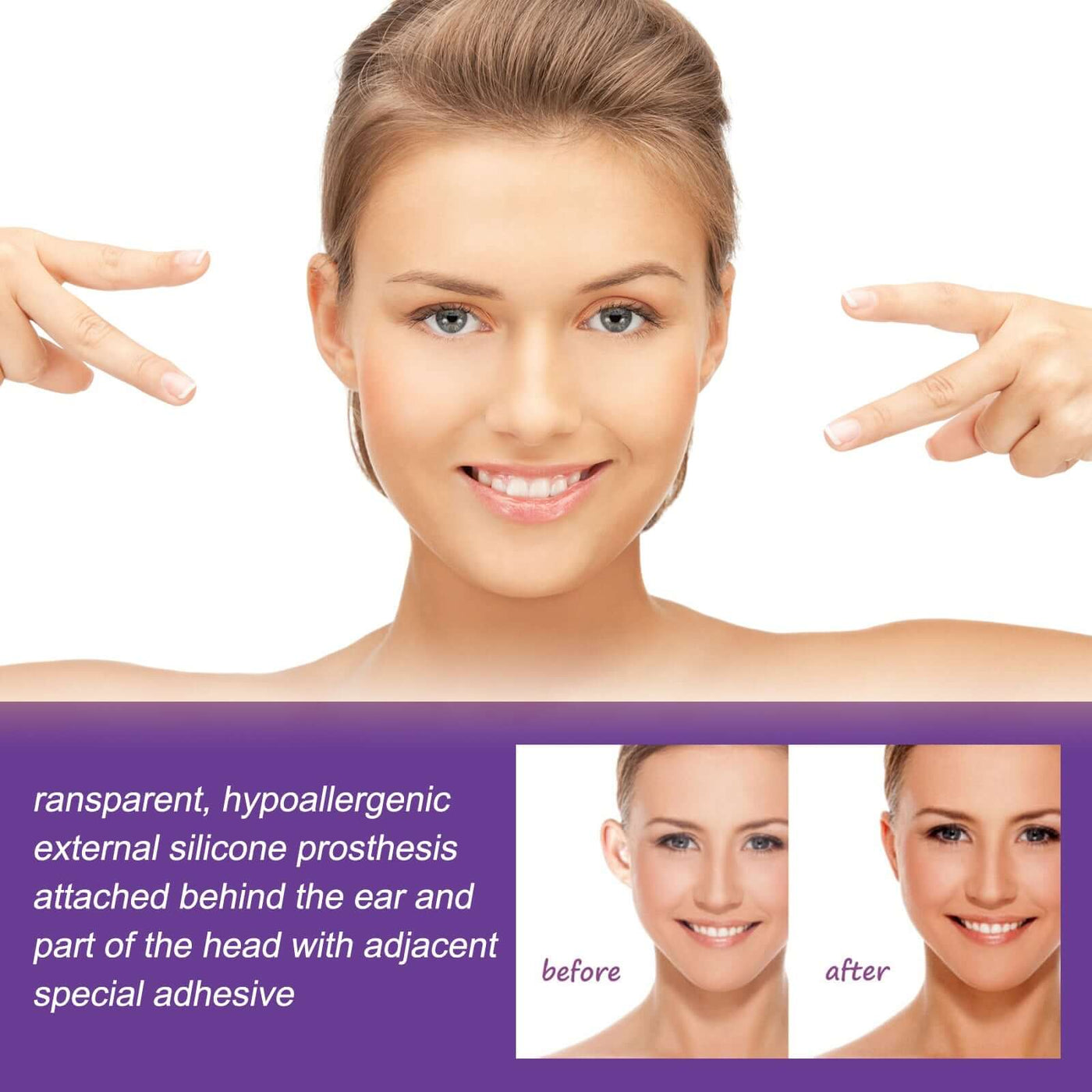 Cosmetic Ear Correctors, Ear Display Small Support Corrects Flapper Ear Pinna Shape Waterproof Ear Stickers eprolo