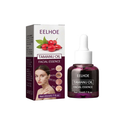 Tamanu Facial Oil, Relieves Acne Marks Fine Lines Moisturizes and Firms Skin Essential Oil eprolo