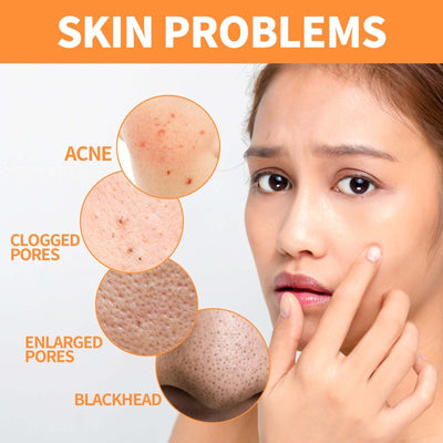 Ginger Yellow Mud Facial Mask Stick, Acne Removing Pore Shrinking Cleaning Solid Facial Mask eprolo