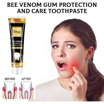 Bee Venom Gingival Toothpaste, Cleaning Stains Breath Fresh Whitening Toothpaste eprolo