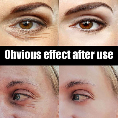Astaxanthin Caviar Eye Cream, Moisturizing Skin Care Firming Fade Lines Eye Cream eprolo