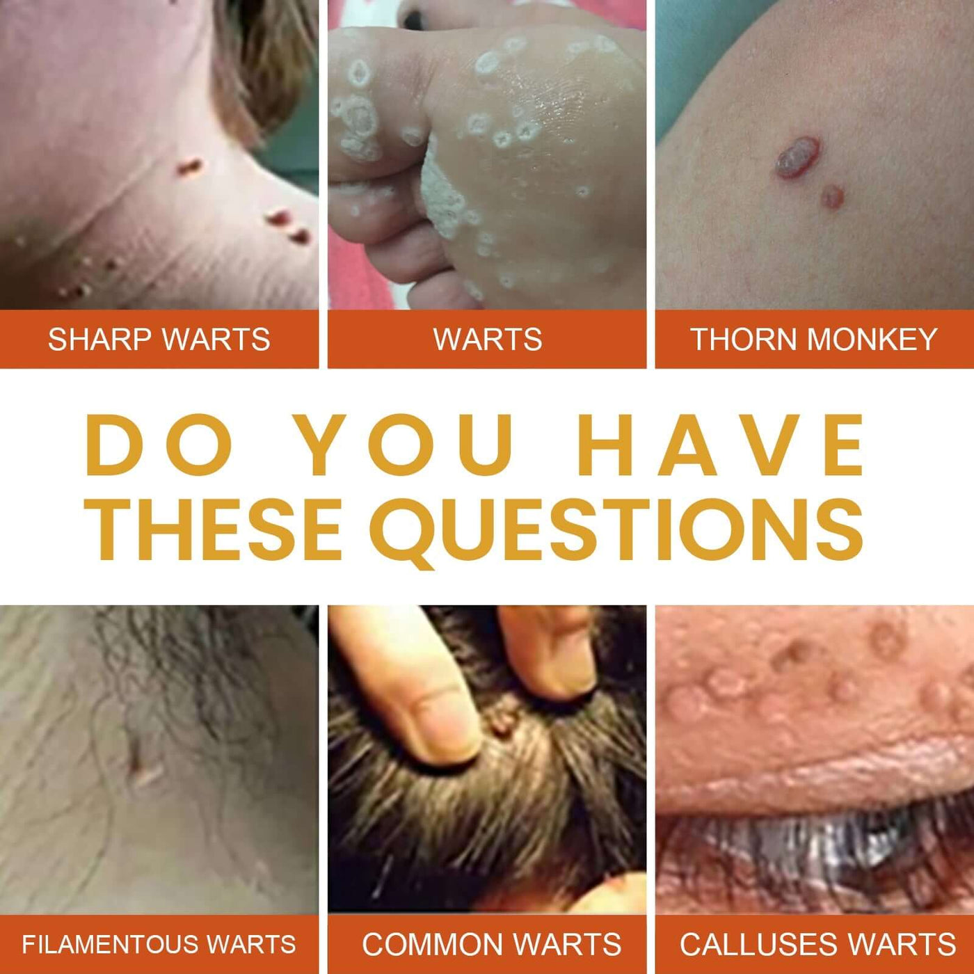 Anti-wart Essence, Anti Warts Fade Moles Corns Smoothing Skin Care Essence eprolo