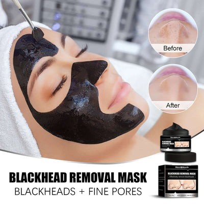 Blackhead Removal Mask, Peel Off Remove Blackhead Activated Carbon Cleansing Face Mask eprolo