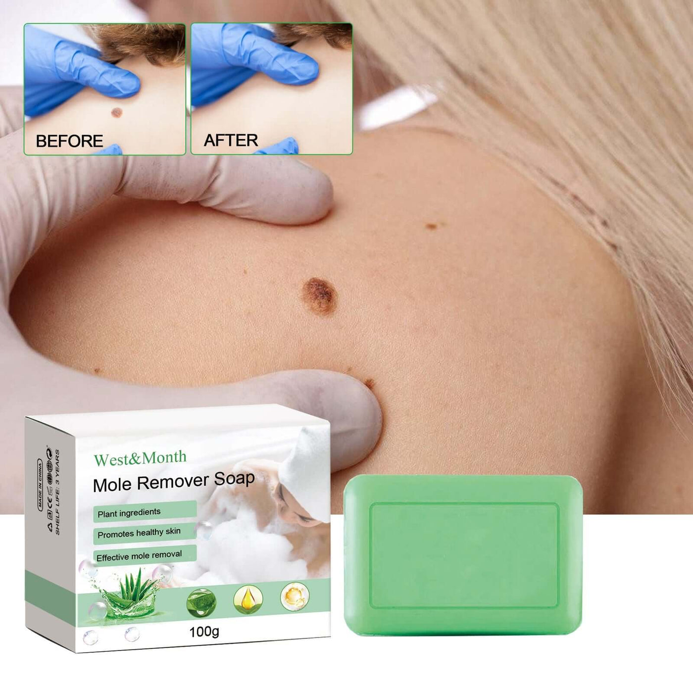 Mole Remover Soap, Repair Meat Granules Corns And Dark Moles, Smooth Skin Anti-wart Cleansing Soap eprolo