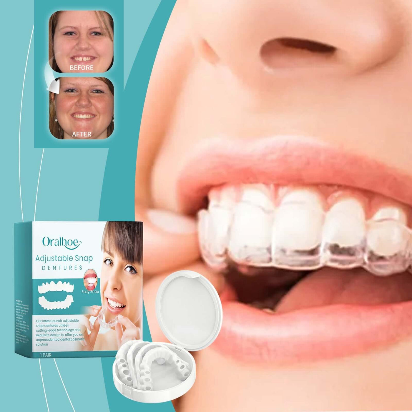 Adjustable Buckle Dentures, Comfortable Adjustable Dentures To Fit The Mouth Chewing Force And Fit The Teeth eprolo