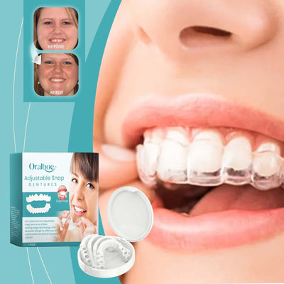 Adjustable Buckle Dentures, Comfortable Adjustable Dentures To Fit The Mouth Chewing Force And Fit The Teeth eprolo
