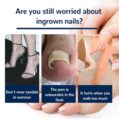 Nail Correction Patch, Nail Insert Correction And Repair Toe Manicure Nail Patch eprolo