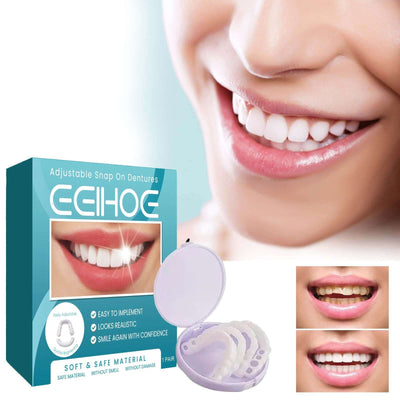 Adjustable Buckle Denture, Temporary Fillings Interdental Fillings Orthodontic Denture Kits eprolo