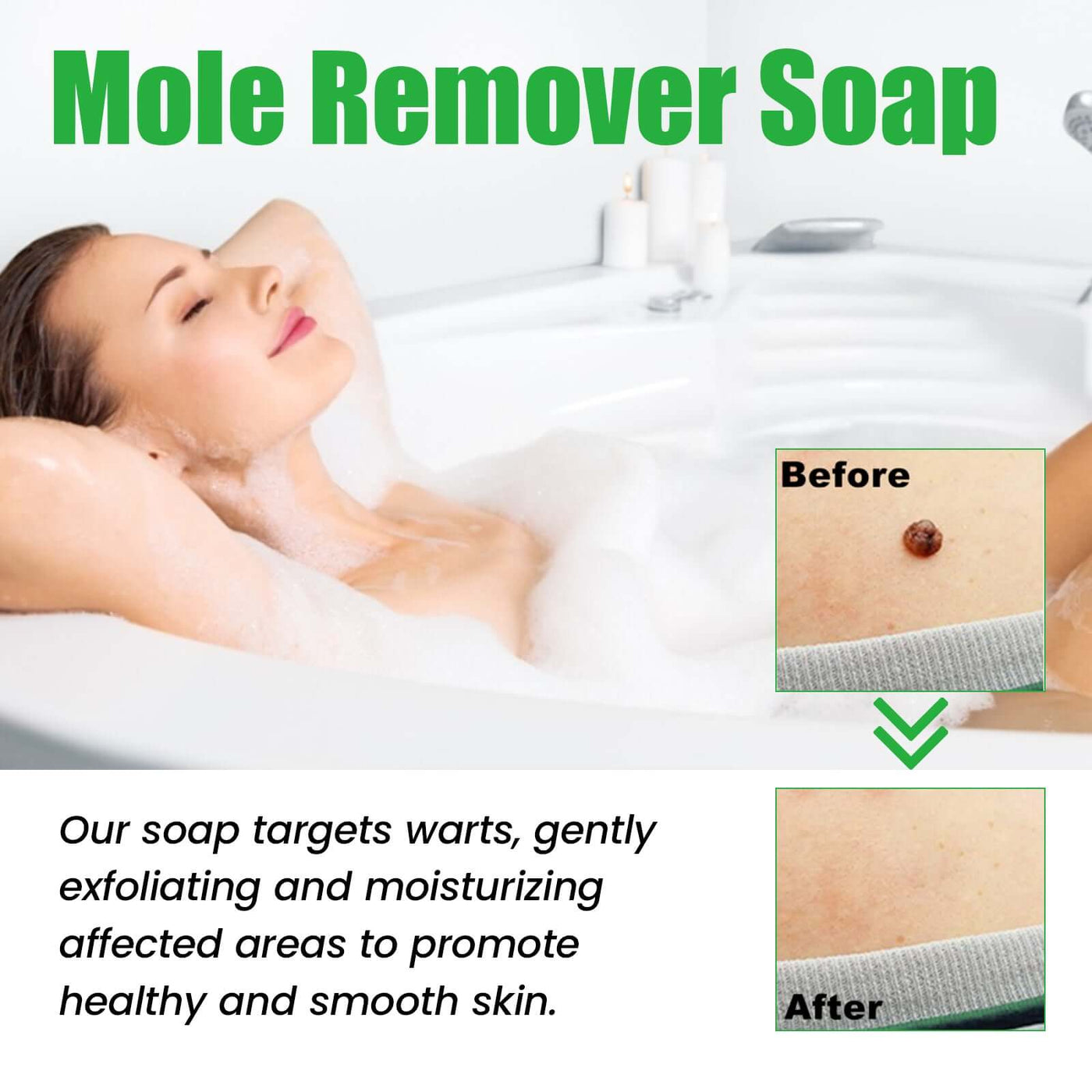 Mole Remover Soap, Repair Meat Granules Corns And Dark Moles, Smooth Skin Anti-wart Cleansing Soap eprolo