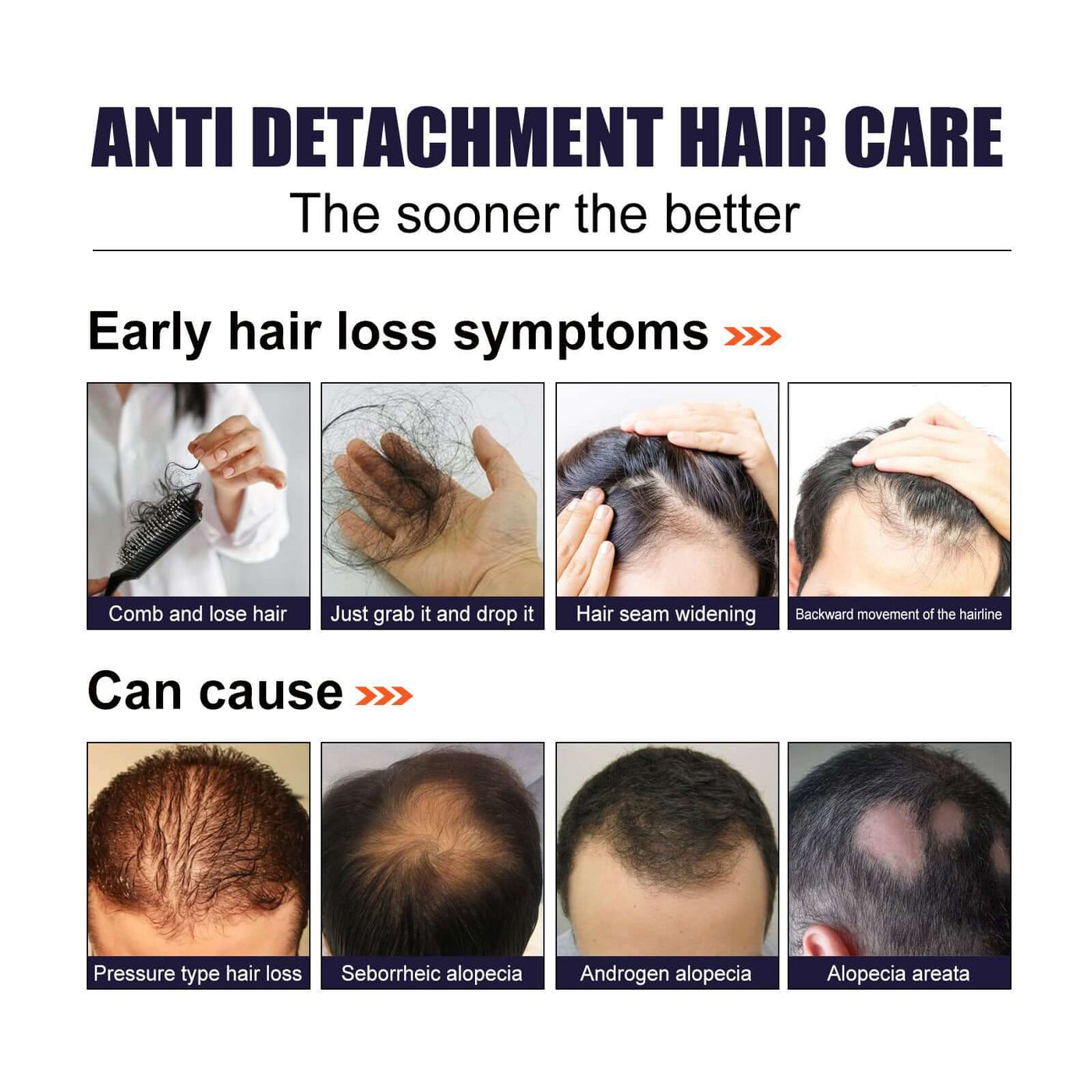 Herbal Hair Essence, Moisturizes Scalp Strong Hair Roots Thick Beard Care Essence eprolo
