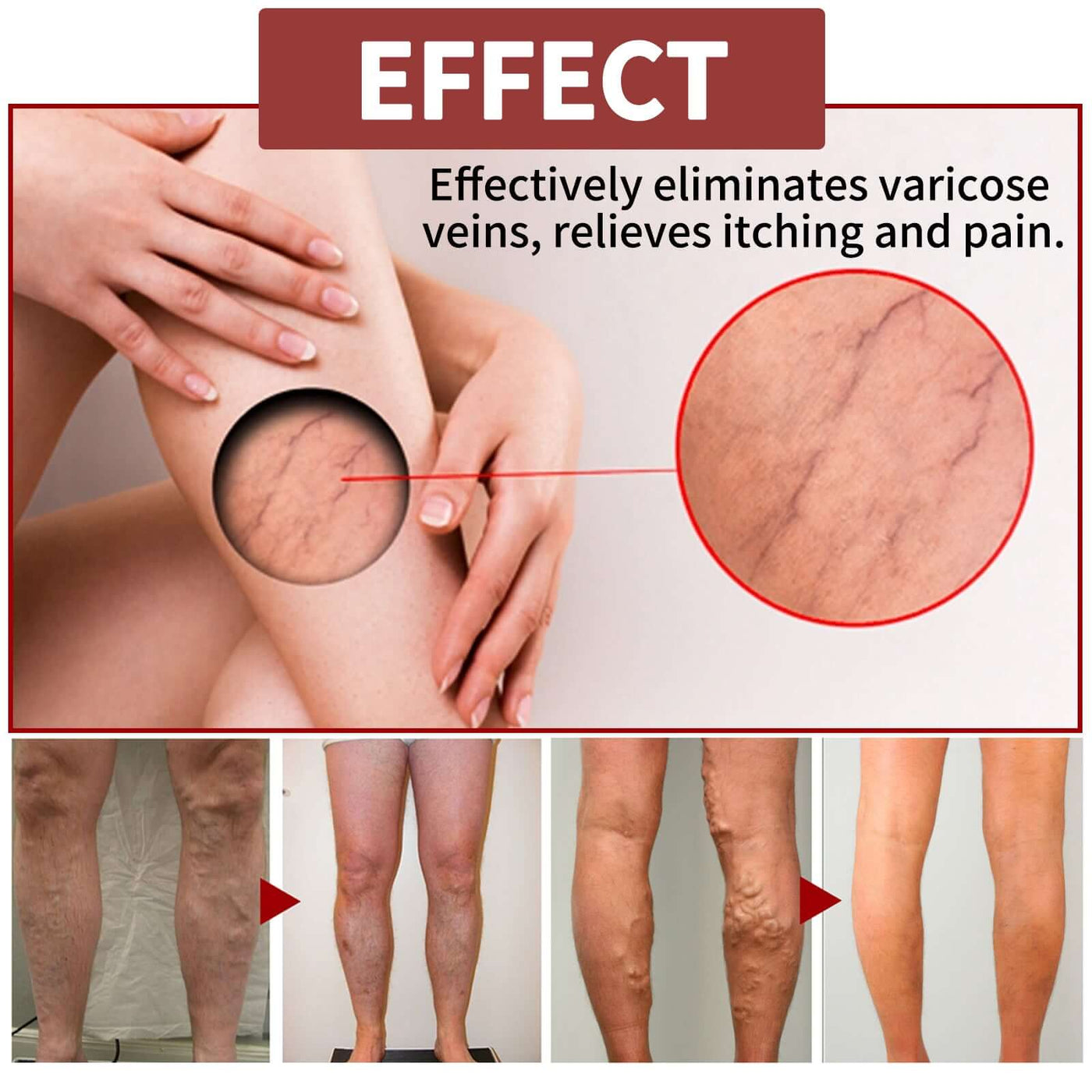 Venous Massage Varicose Cream, Relieves Bulging Leg Blood Vessels And Swollen Leg Earthworm Venous Massage Cream eprolo