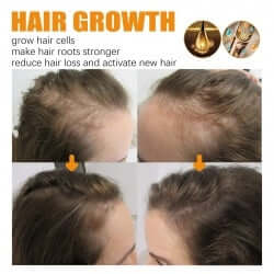 Biotin Hair Essential Oil eprolo