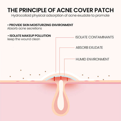 Hydrocolloid pimple patches for face in cute star shape