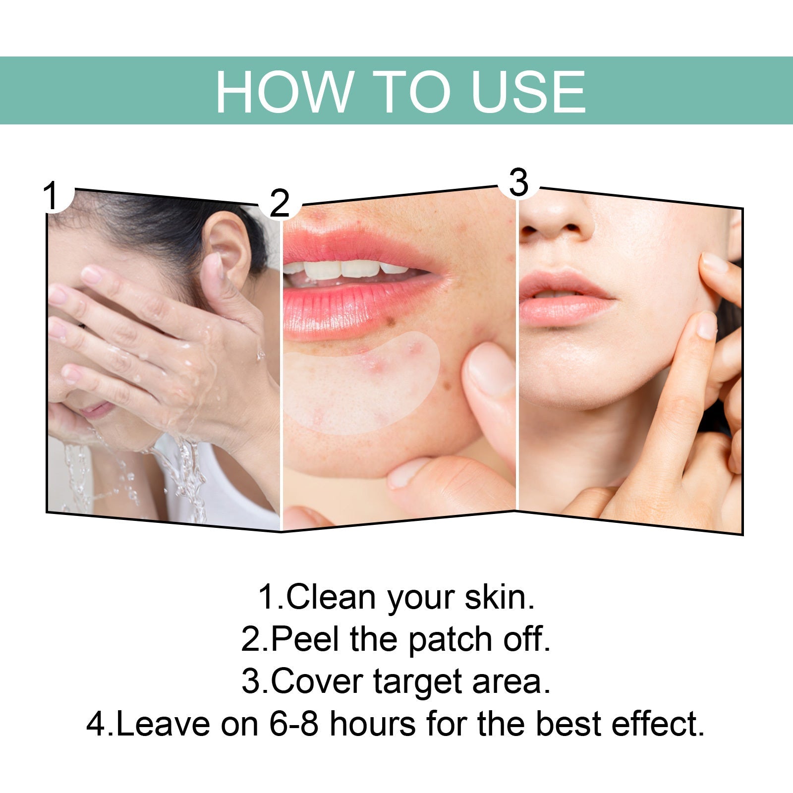 EELHOE Acne Relief Mask Patch Is A Gentle, Non-irritating Acne Mask That Helps To Reduce Acne Marks And Heal Acne. eprolo