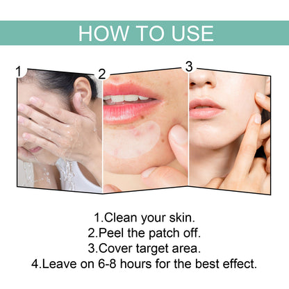 EELHOE Acne Relief Mask Patch Is A Gentle, Non-irritating Acne Mask That Helps To Reduce Acne Marks And Heal Acne. eprolo